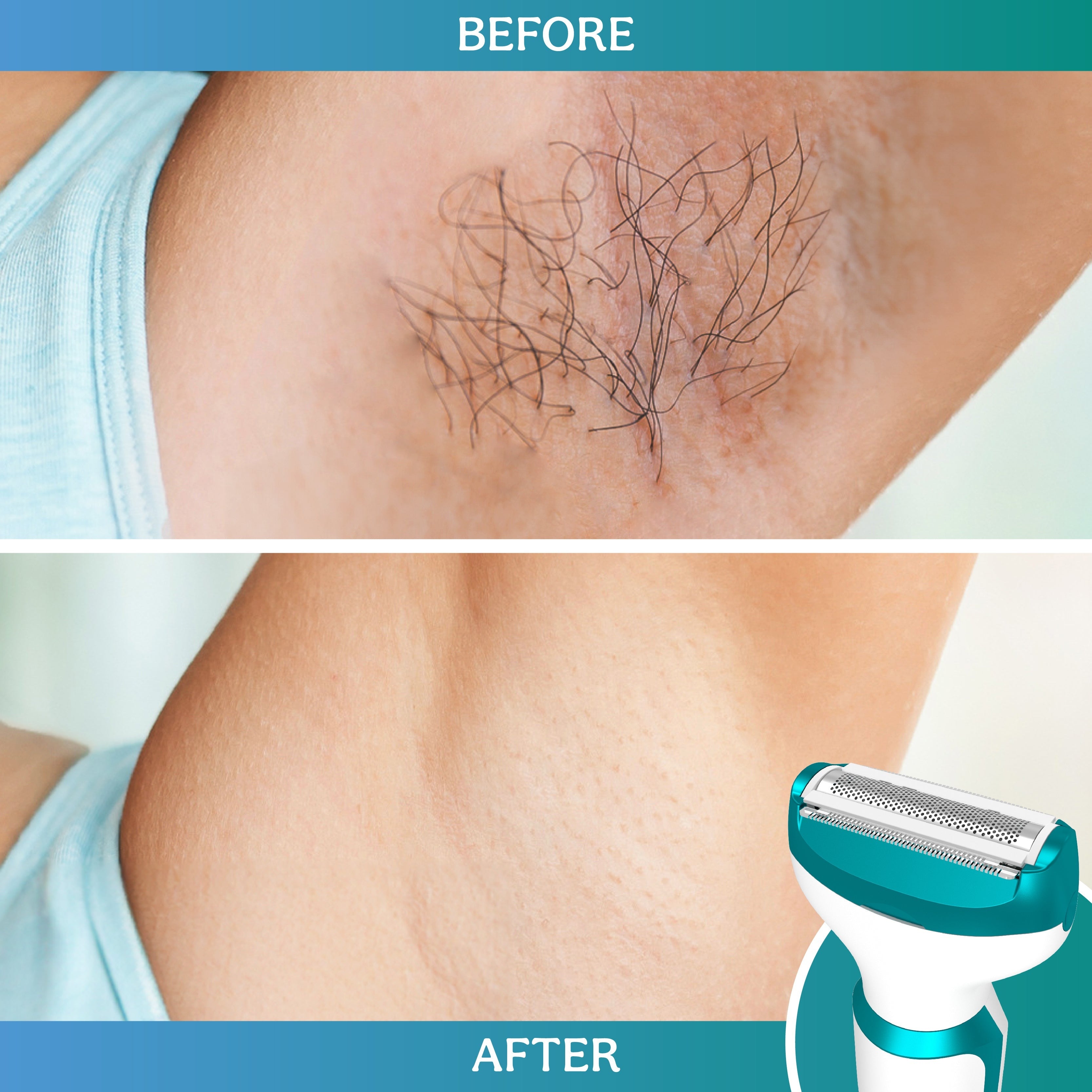 Caresmith Bloom - Facial Hair Before vs After